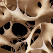 Osteoporosis Diagnosis Disease