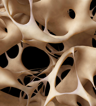 Osteoporosis Diagnosis Disease