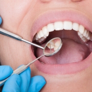 Gluten Free Endodontic Procedure